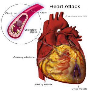 Benefits of Nattokinase and Serrapeptase-Clot